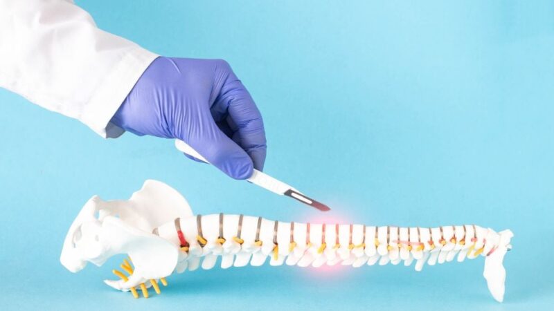 15 nguyên nhân gây đau lưng có thể bạn chưa biết 25 Gai cột sống gây đau lưng