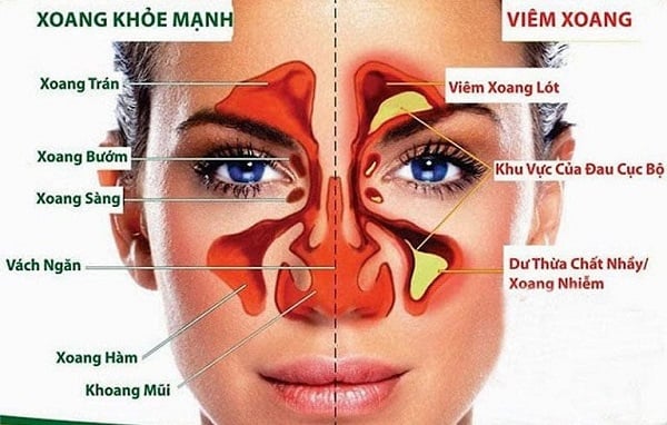 cách massage trị viêm xoang hiệu quả