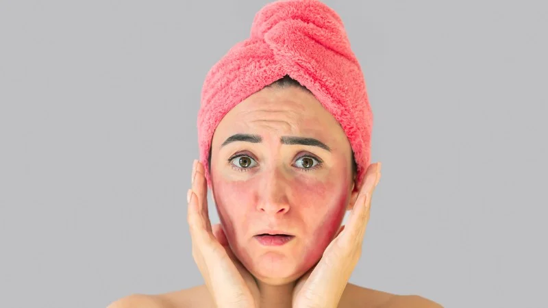 Tác Hại Của Dầu Oliu Với Sức Khỏe: Những Điều Ít Ai Nói Ra 19 Dầu oliu có thể gây phát ban trên da