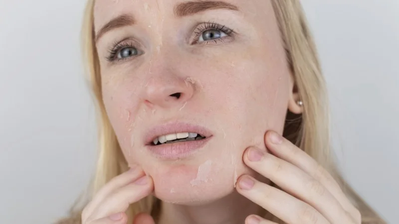 Tác Hại Của Dầu Oliu Với Sức Khỏe: Những Điều Ít Ai Nói Ra 20 Dầu oliu không thích hợp cho da khô