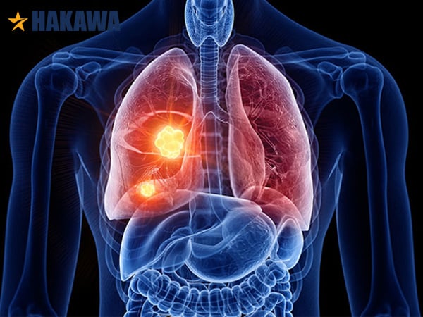 Hít bụi bẩn gây ra bệnh phổi và đường ruột