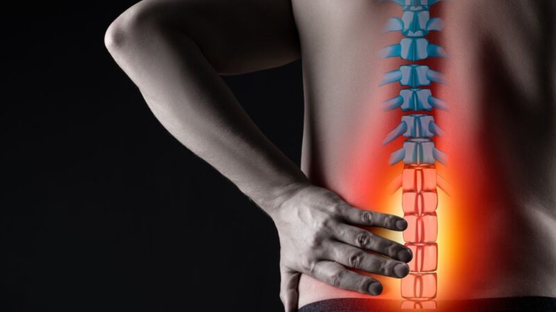 Ngủ dậy bị đau lưng, Nguyên nhân và cách khắc phục 23 Mắc bệnh cốt sống gây đau lưng khi ngủ dậy