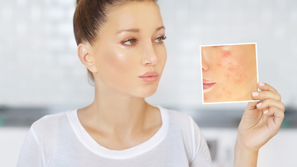 Massage mặt có tác dụng gì cho làn da và sức khỏe? 23 Massage mặt giúp đẩy nhanh quá trình liền sẹo