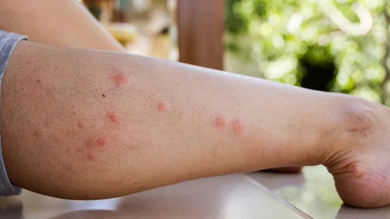 12 cách diệt kiến ba khoang vĩnh viễn, an toàn cho sức khoẻ 25 Vì sao cần diệt kiến ba khoang một cách triệt để?