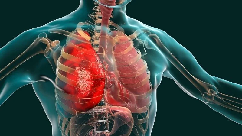 6 cách đuổi muỗi tự nhiên hiệu quả, an toàn không độc hại 12 Đuổi muỗi tự nhiên an toàn cho hệ hô hấp và môi trường sống