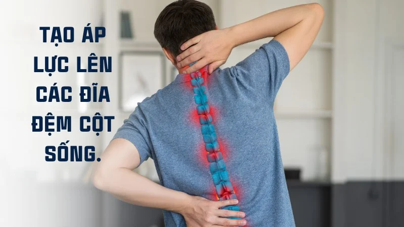 Bệnh nhân thoát vị đĩa đệm có nên nằm võng? Lợi và hại 9 Nằm võng sai cách sẽ tạo áp lực lên các đĩa đệm cột sống
