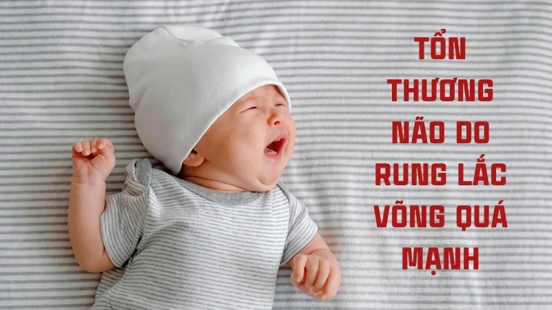 Trẻ 4 tháng nằm võng được không? lợi ích và tác hại 15 Tổn thương não do rung lắc võng quá mạnh