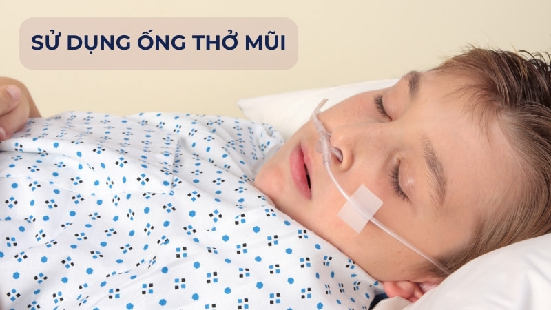 Hướng dẫn SỬ DỤNG máy tạo oxy tại nhà và các LƯU Ý cần biết 14 Kết nối với ống thở mũi và mặt nạ thở