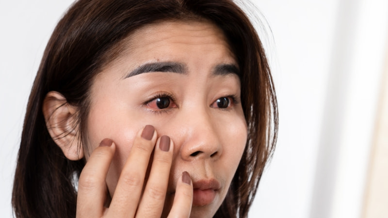 12 tác hại của bụi mịn đến sức khỏe và kinh tế 14 Gây viêm nhiễm ở mắt, mũi, và cổ họng