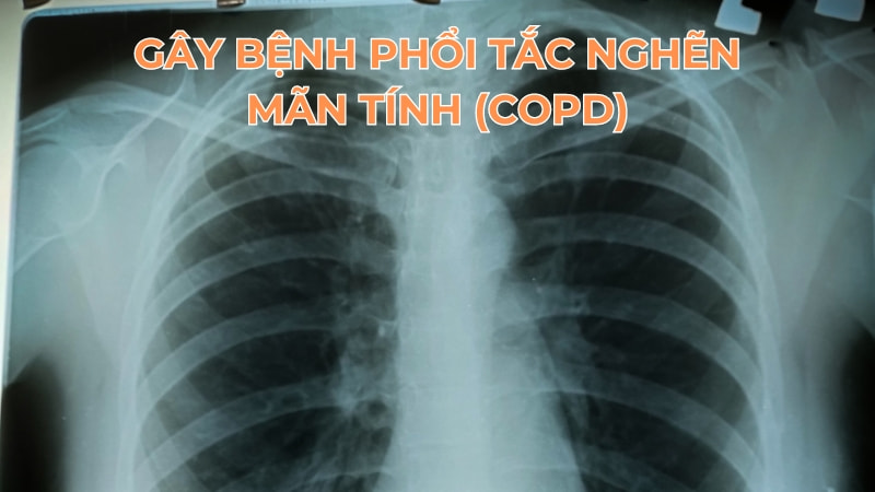12 tác hại của bụi mịn đến sức khỏe và kinh tế 10 Gây bệnh phổi tắc nghẽn mãn tính (COPD)
