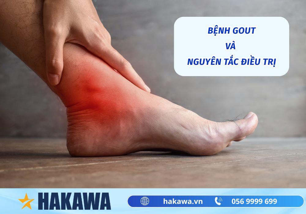 Nước ion kiềm có tốt cho người bị gout không theo các NGHIÊN CỨU 10 bệnh gout và nguyên tắc điều trị