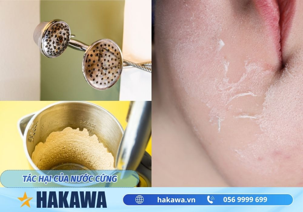 Nước cứng là gì ? Nguyên nhân và cách làm mềm loại nước này 9 Tác hại của nước cứng