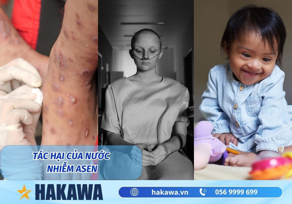 Nước nhiễm Asen là gì ? Tác hại và cách xử lý 8 Tác hại của nguồn nước nhiễm Asen